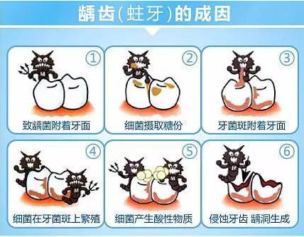 上海口腔医院牙齿有个洞补牙多少钱
