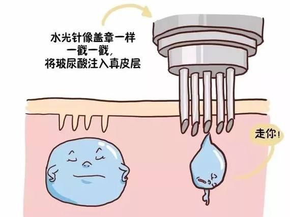 上海微整形水光注射一针副作用大吗