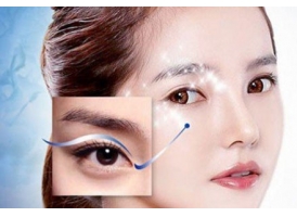 【上海美莱】割的双眼皮能看出来吗 会不会不自然