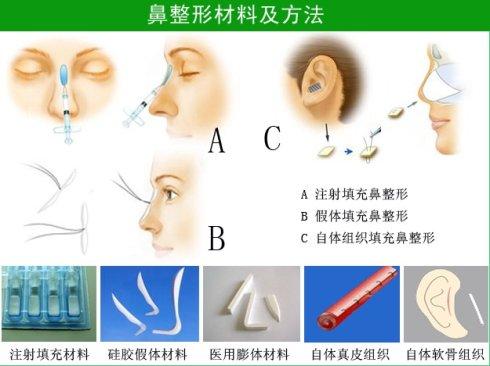上海硅胶隆鼻对人体有害吗