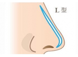 上海做隆鼻手术价格是多少 隆鼻术后多久恢复